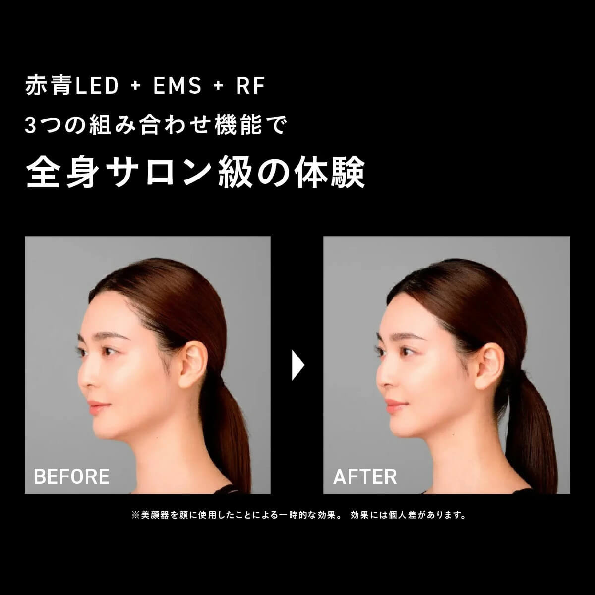 ブライト ELEKI BRUSH＋（エレキブラシプラス） ブラック BRT-FSB180 【前払い不可】【代引き不可】【同梱不可】0